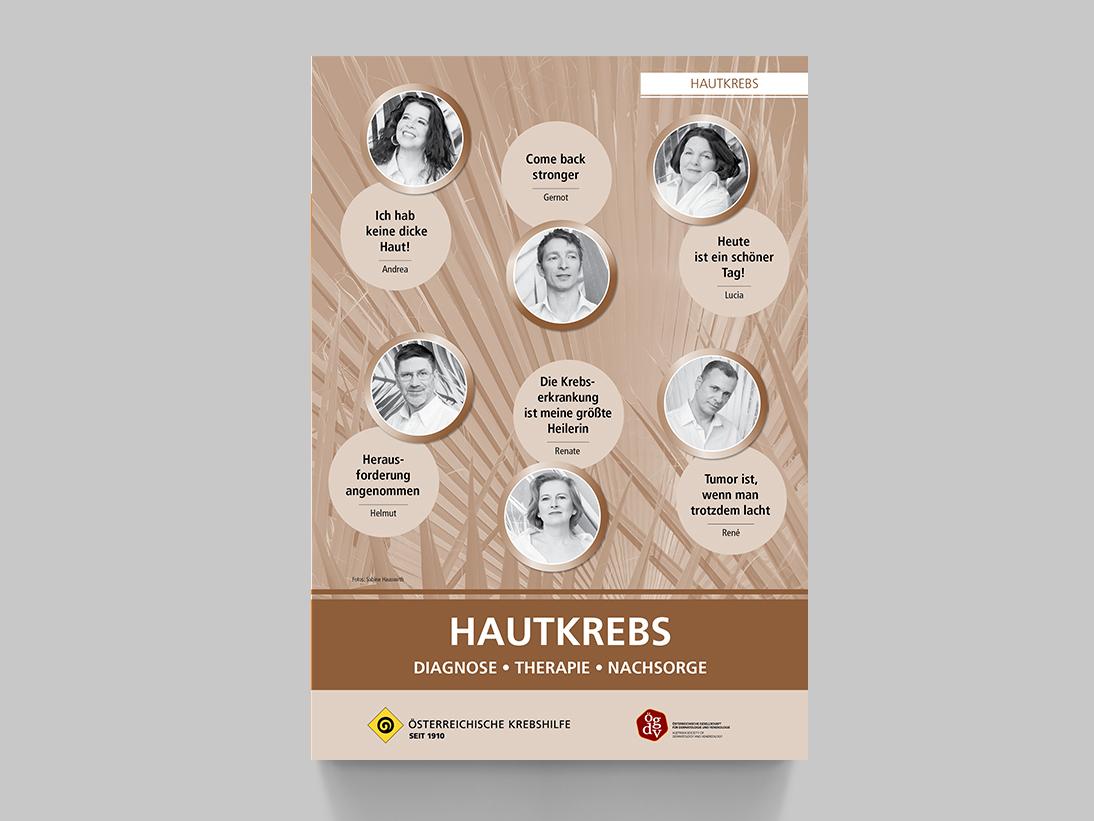 Hautkrebs